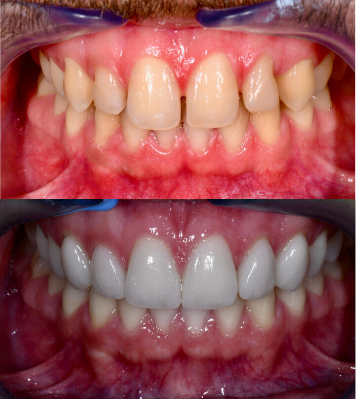 Comment valoriser la maintenance?